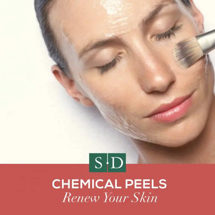 Chemical Peel in Birmingham, AL