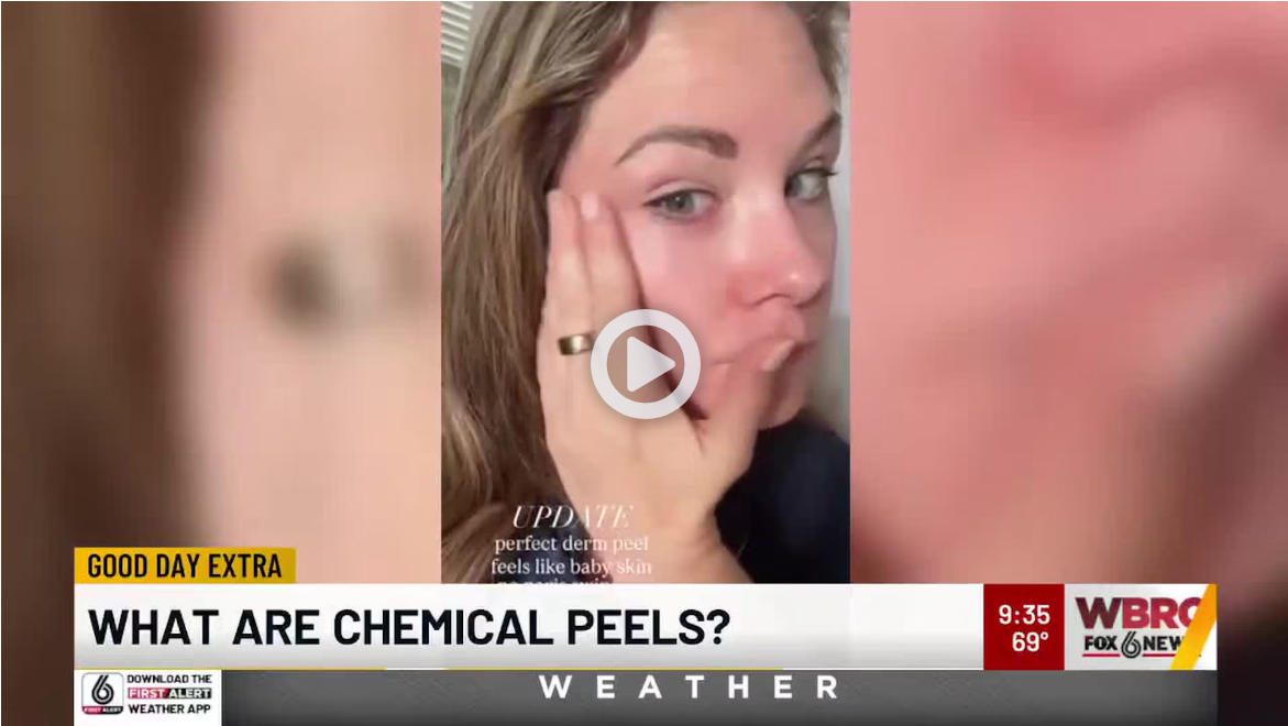 what-are-chemical-peels What are Chemical Peels