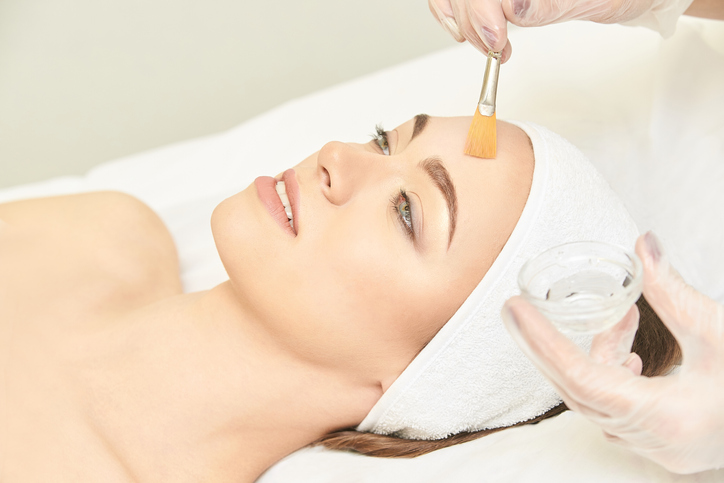 Chemical Peel in Birmingham, AL