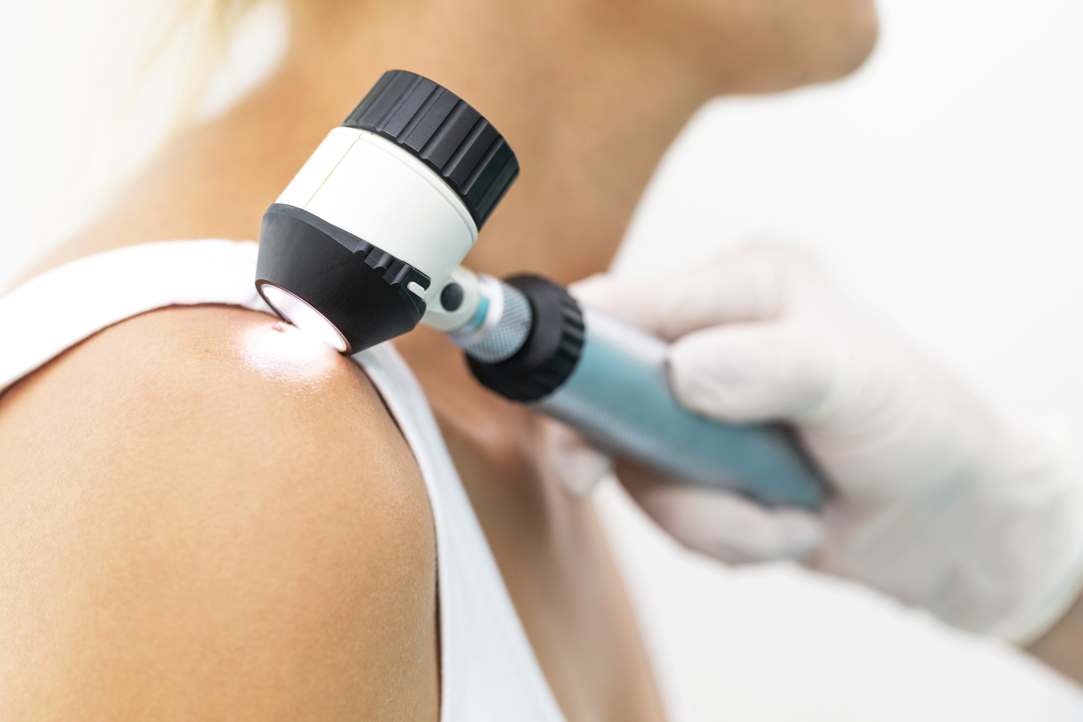 Skin cancer Dermatologists of Birmingham