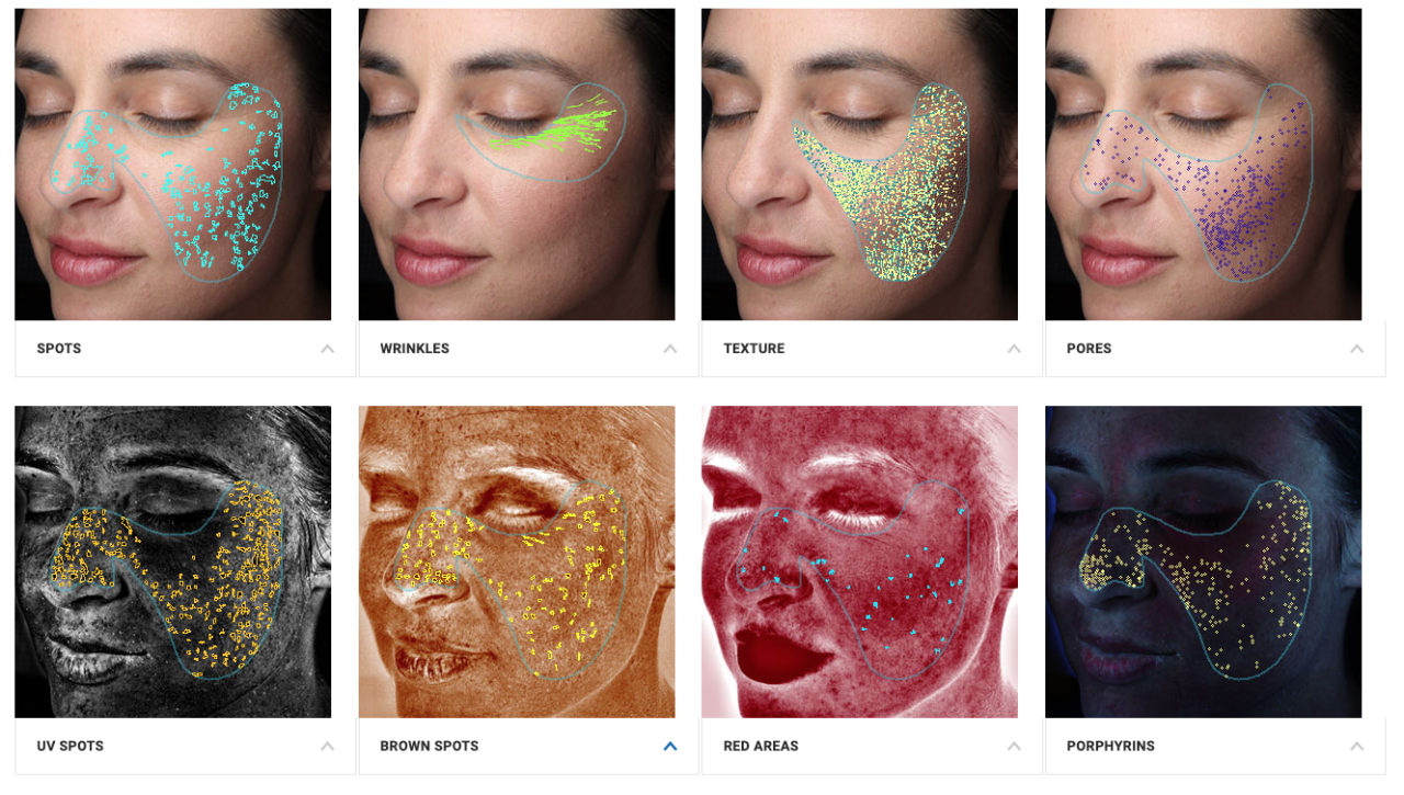 Skin Analysis - Dermatologists Of Birmingham