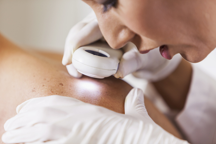 Medical Dermatology in Birmingham, AL